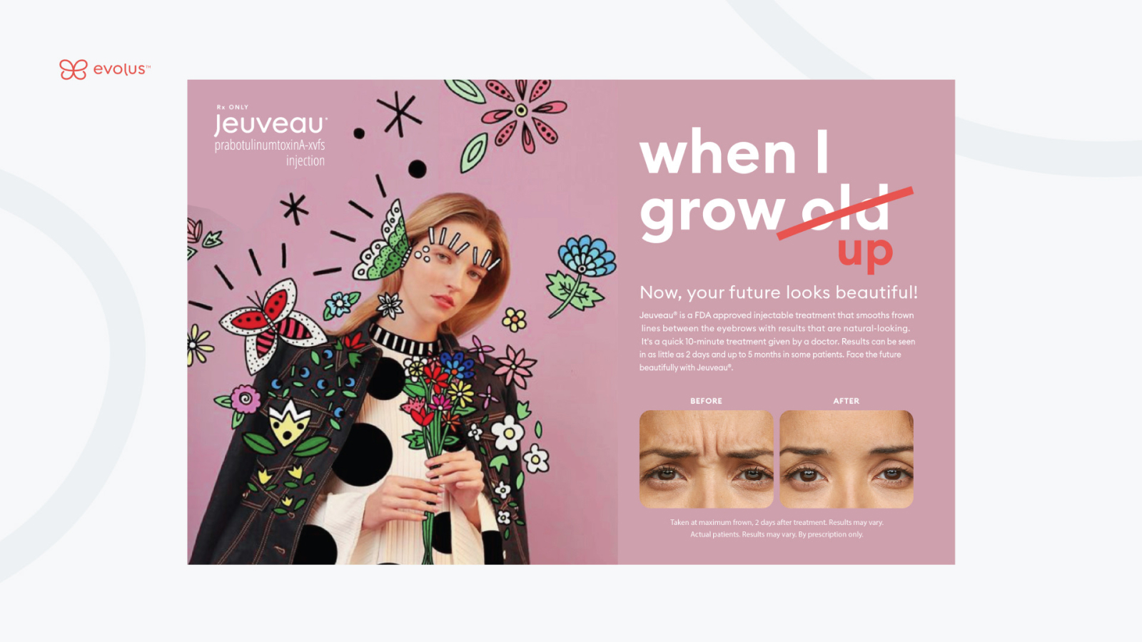 evolus grow ads 1